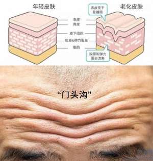 汽车加速时哗啦哗啦响(小心抬头纹变多，可能是你的身体在发出警告……)